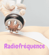 Radiofréquence